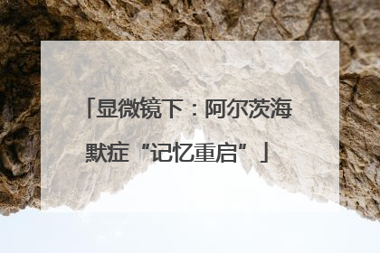显微镜下：阿尔茨海默症“记忆重启”